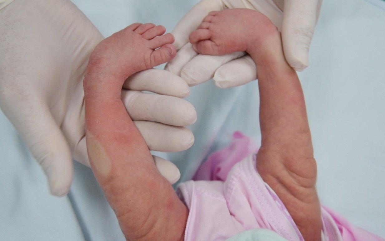 Con mac di tat do sai lam cua me khi mang thai hinh anh