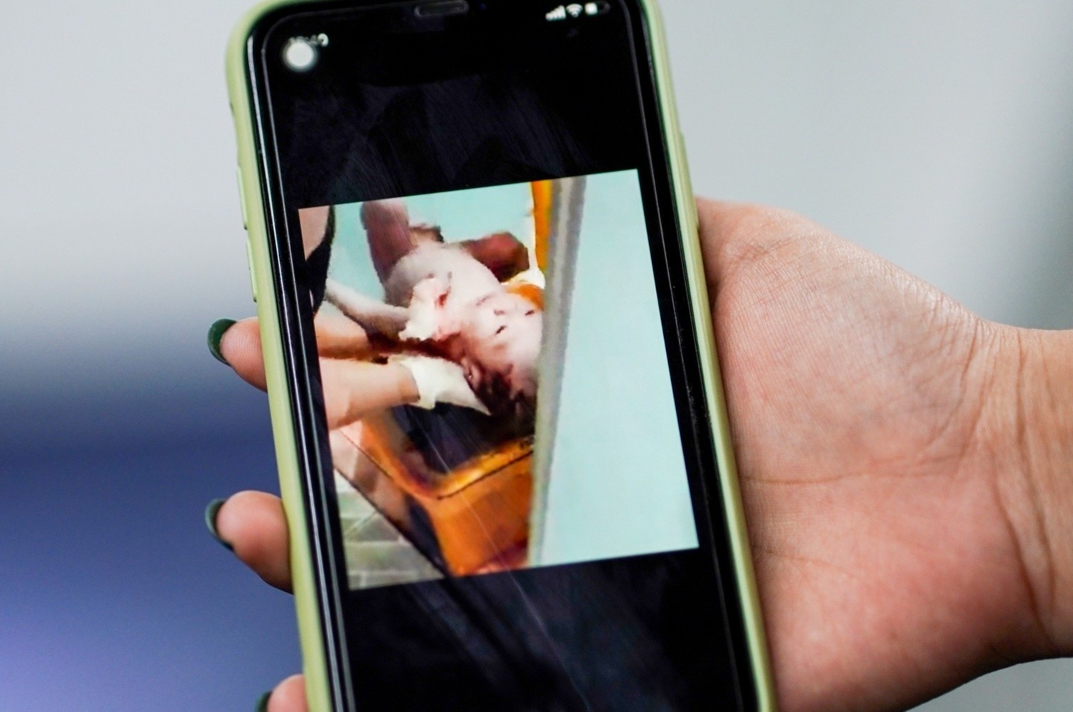 San phu vut con moi sinh trong thung rac benh vien hinh anh