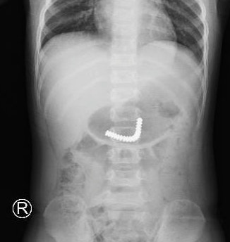 Be trai nuot 18 vien nam cham anh 1