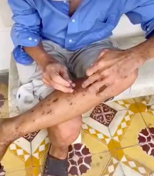 khoet da vi nghi co sinh vat trong nguoi anh 1