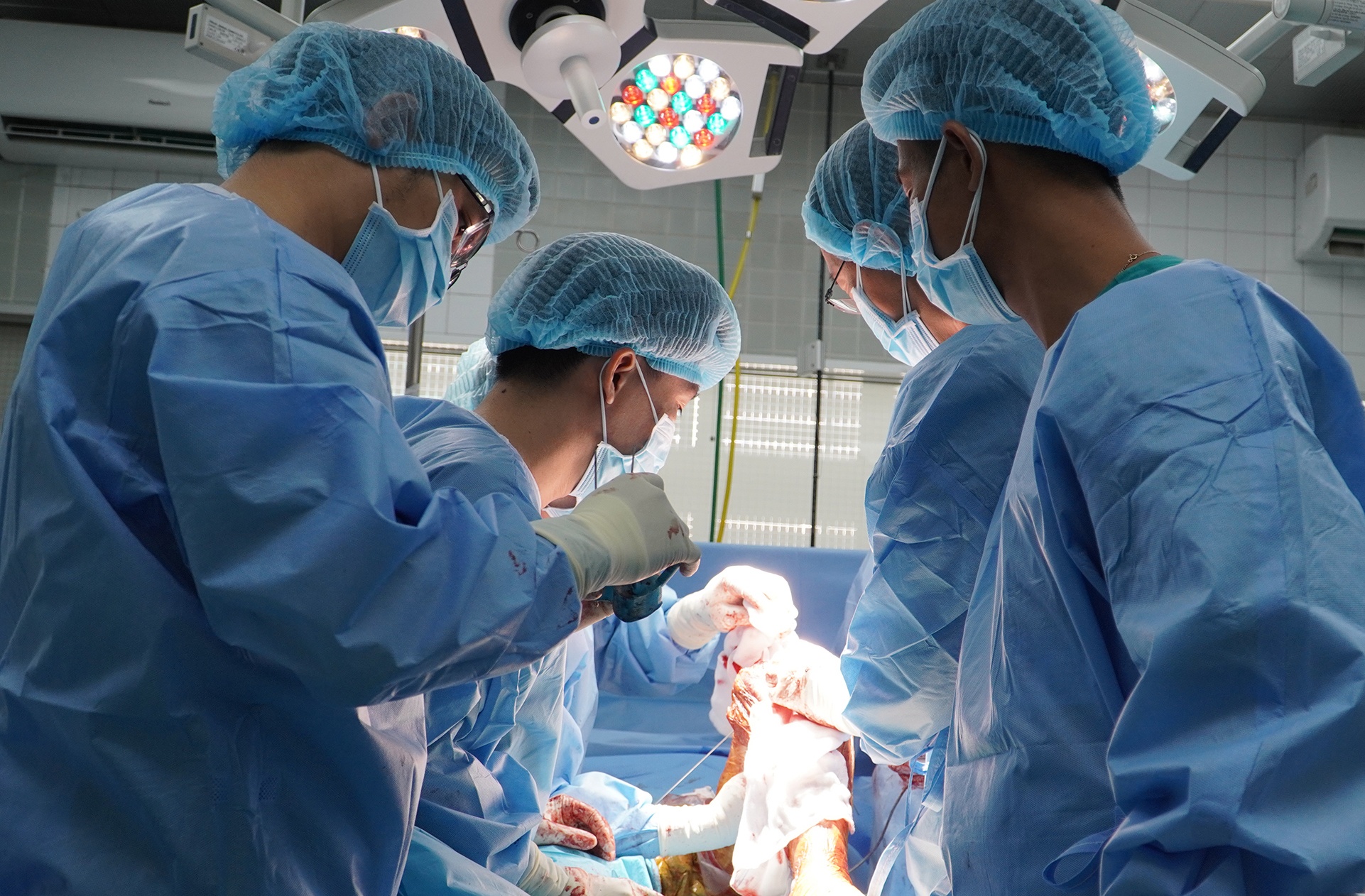 dieu tri ung thu xuong bang manh ghep hop kim anh 1