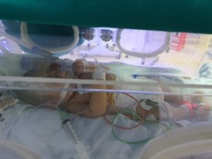 bé sơ sinh bị uốn ván ảnh 1 be so sinh bi uon van anh 1