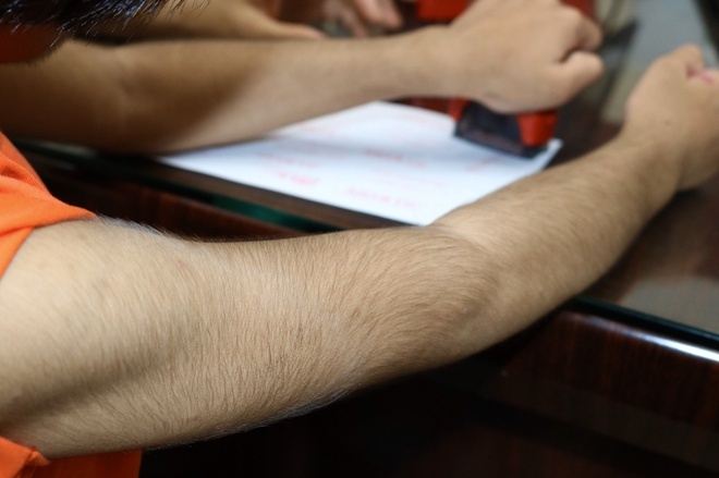 nhung can benh la lung o Viet Nam anh 2