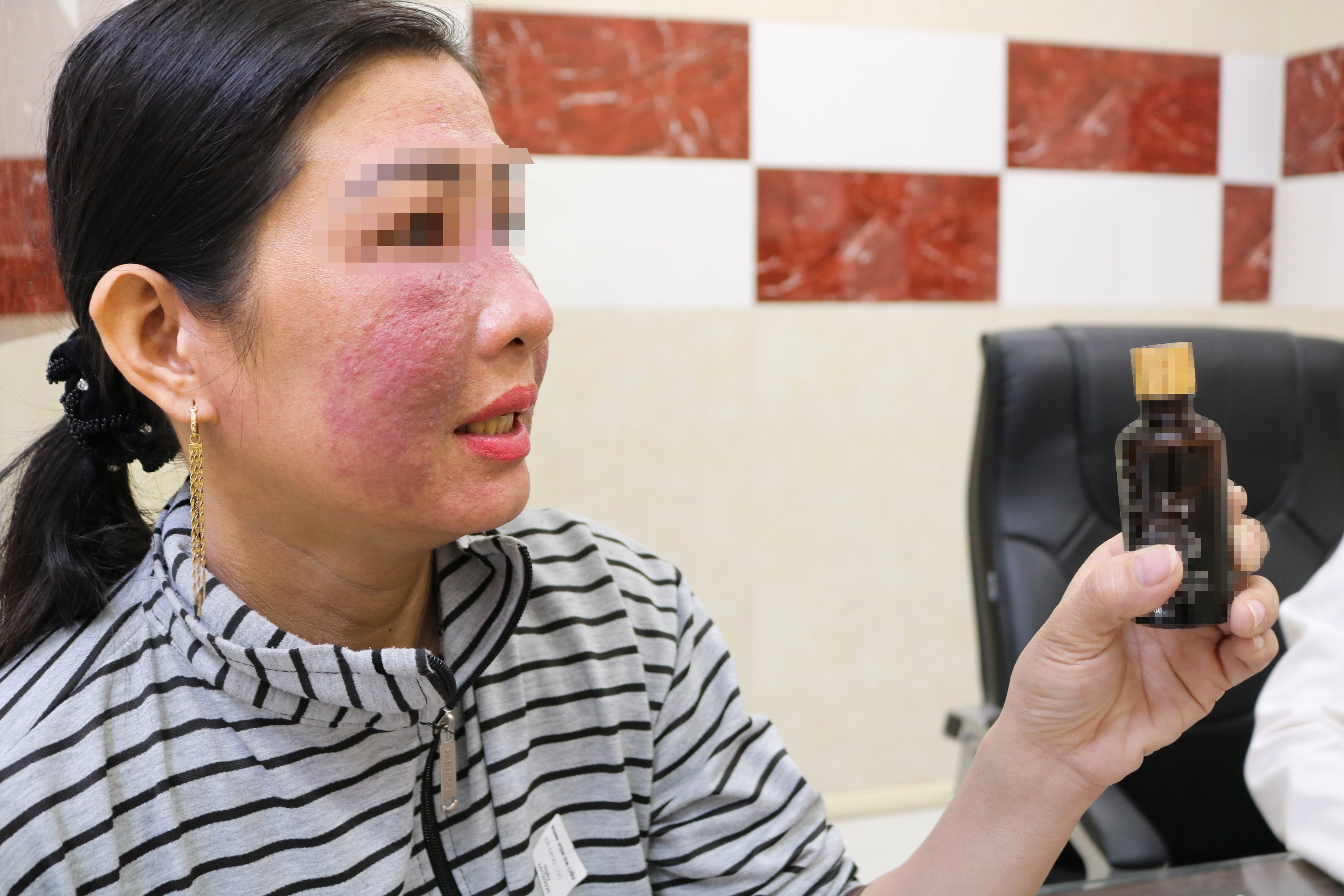 Hang chuc nguoi nhap vien vi dung my pham lam trang da cap toc hinh anh