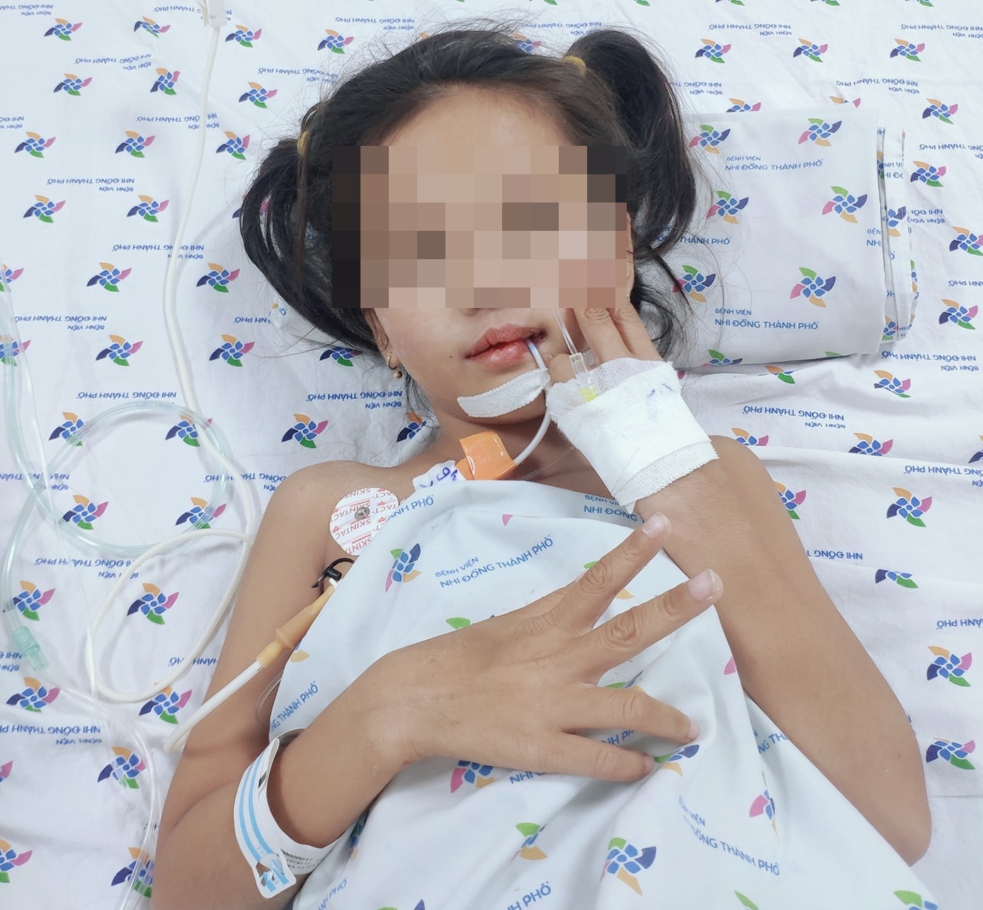 Hội chứng Guillain-Barré khiến bé gái liệt tứ chi ảnh 1 Hoi chung Guillain-Barre khien be gai liet tu chi anh 1