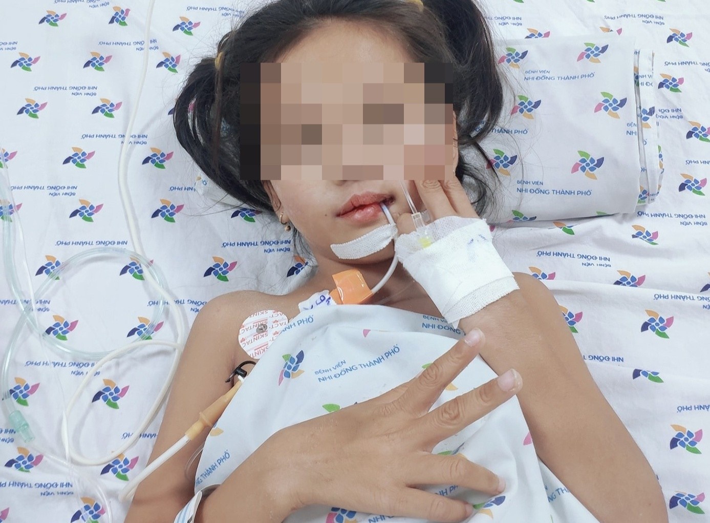 Can benh khien be 7 tuoi dot ngot mat tieng, liet dan tu chi hinh anh