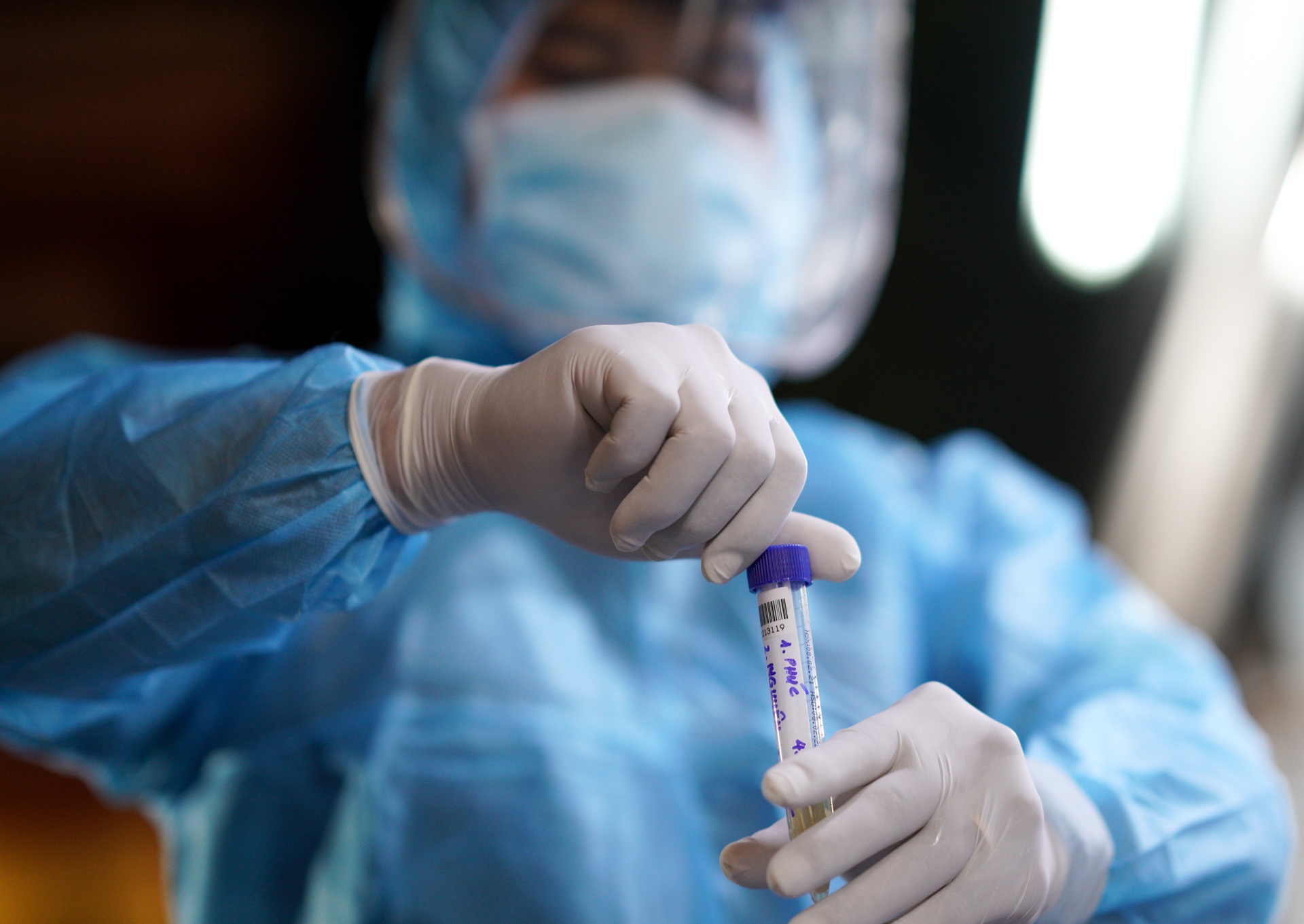 Them benh nhan mac Covid-19 anh 1