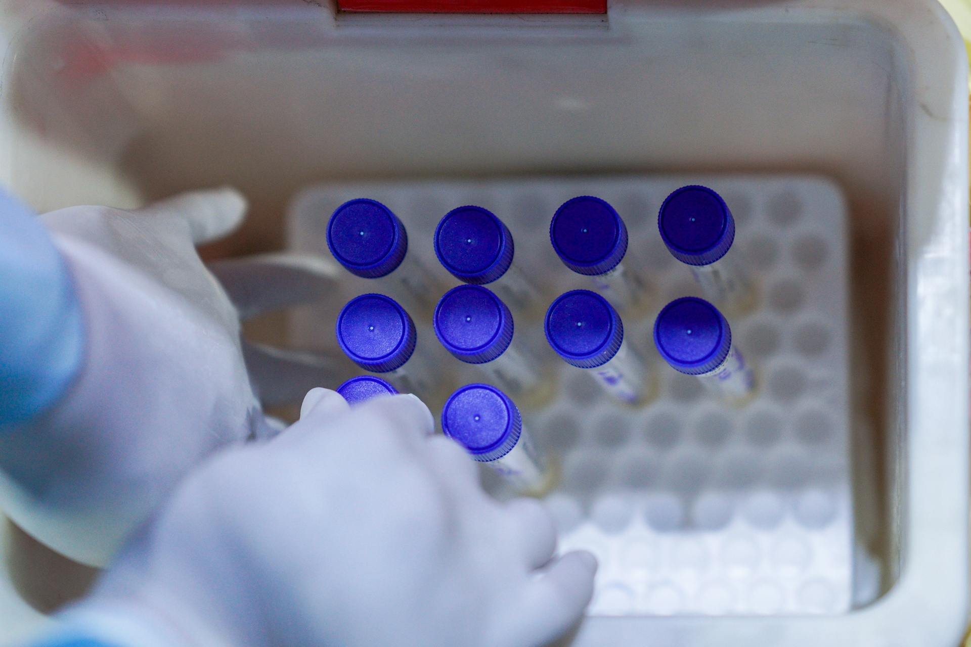 lay mau xet nghiem Covid-19 tai quan nhau anh 4