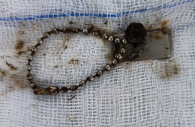 Be trai bi thung ruot do nuot chuoi hat nam cham anh 1