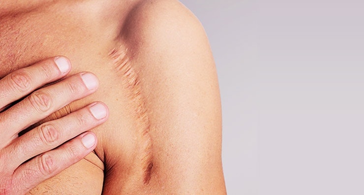 nguyen nhan va cach dieu tri seo loi anh 2