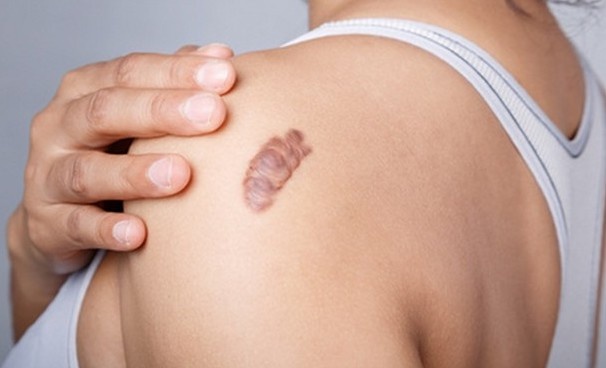 Vi sao seo loi kho tri? hinh anh