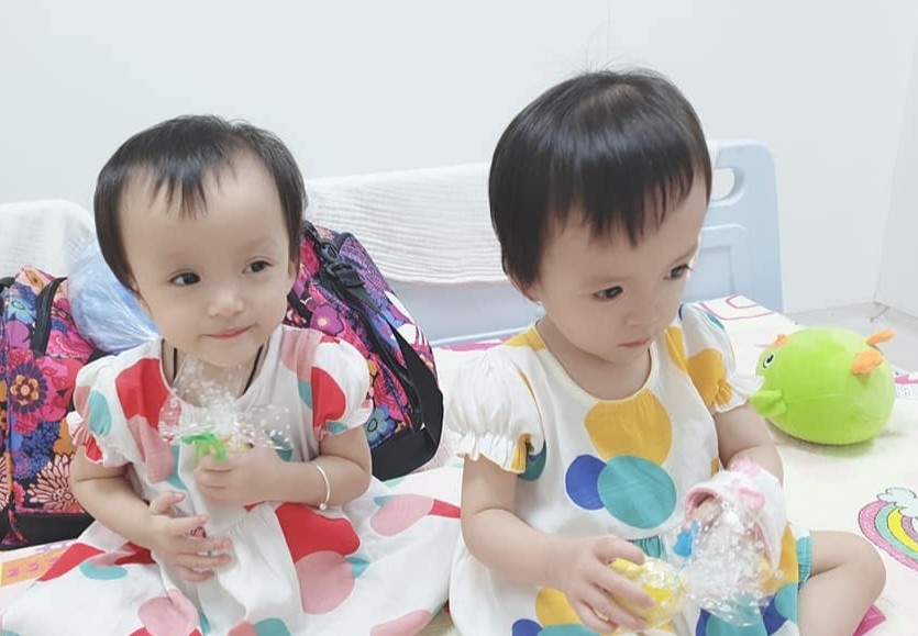mổ tách song sinh  ảnh 2 mo tach song sinh anh 2