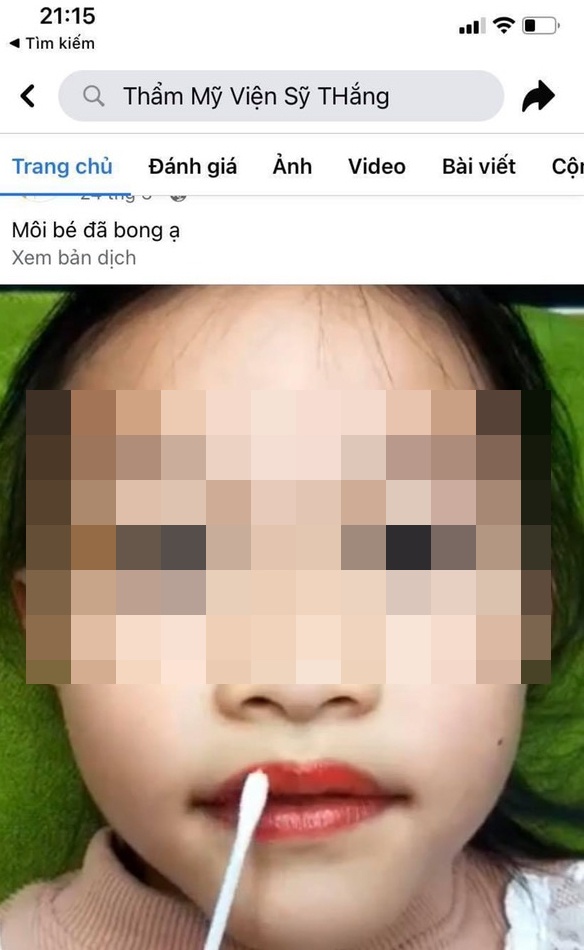 Thẩm mỹ viện phun môi cho bé gái 5 tuổi ảnh 1 Tham my vien phun moi cho be gai 5 tuoi anh 1