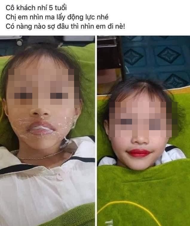 Thẩm mỹ viện phun môi cho bé gái 5 tuổi ảnh 2 Tham my vien phun moi cho be gai 5 tuoi anh 2