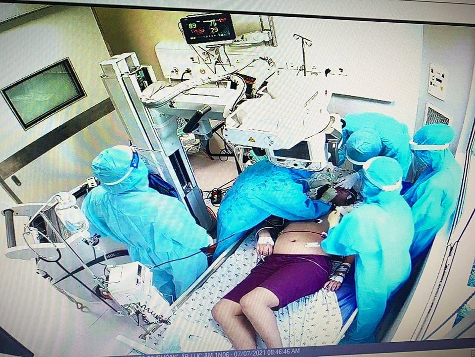 Bé gái mắc Covid-19 tiên lượng nặng ảnh 1 Be gai mac Covid-19 tien luong nang anh 1