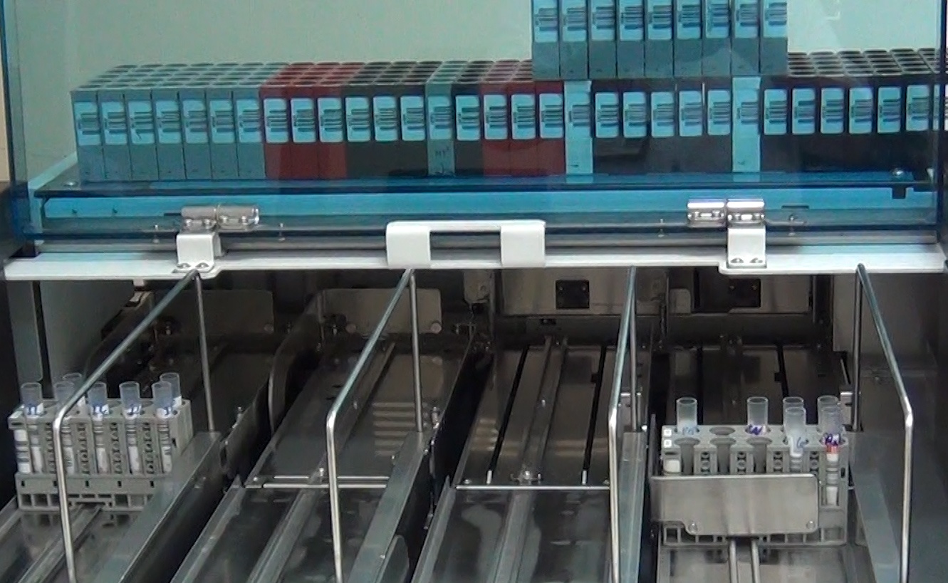 Bệnh viện Chợ Rẫy xét nghiệm kháng thể  ảnh 1 Benh vien Cho Ray xet nghiem khang the anh 1