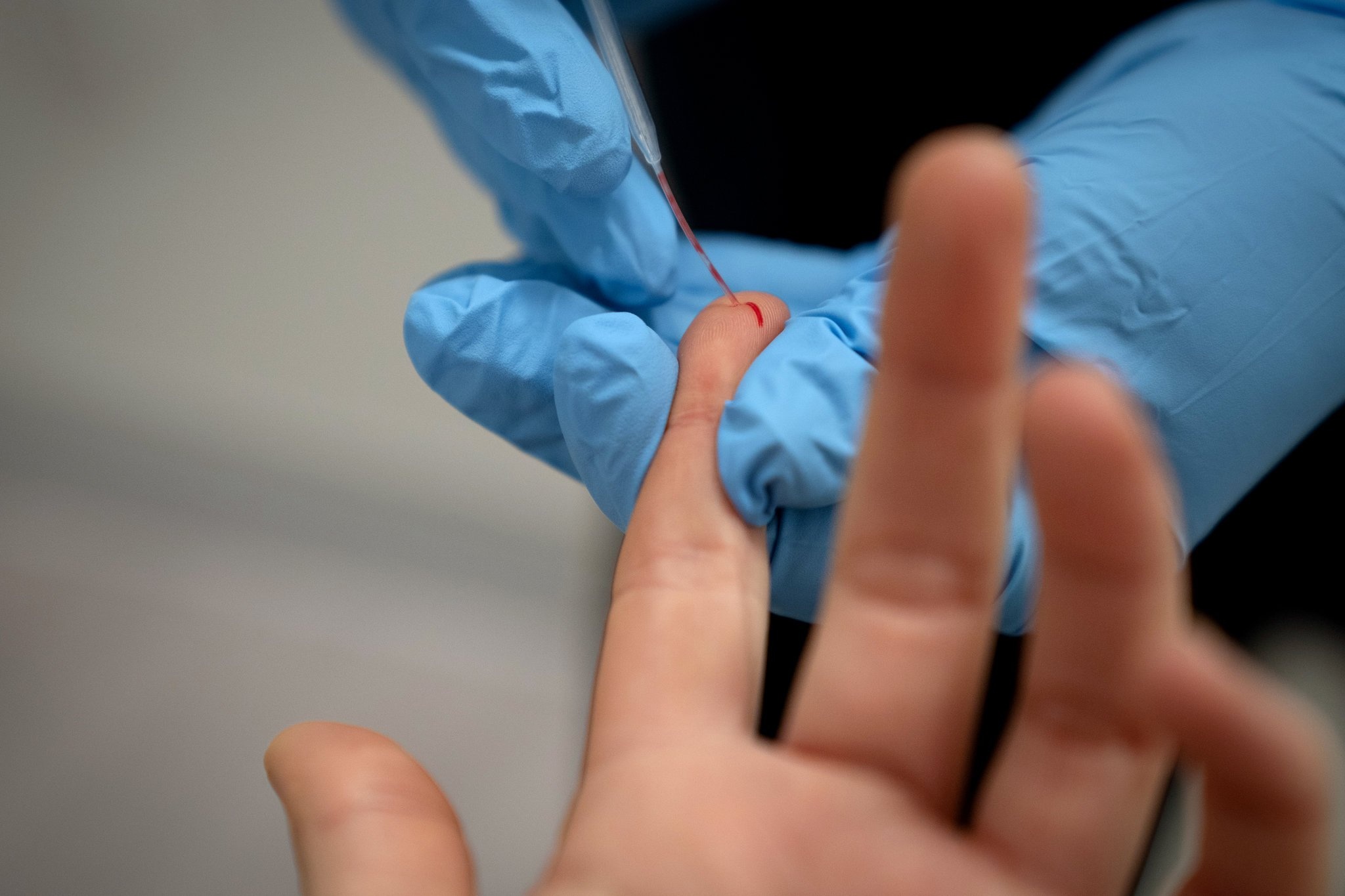 xet nghiem khang the sau tiem vaccine anh 1