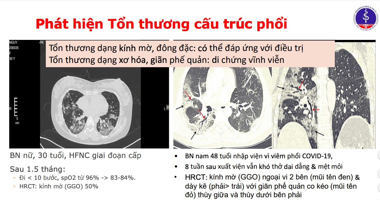 dich Covid-19 bung phat o TP.HCM anh 1
