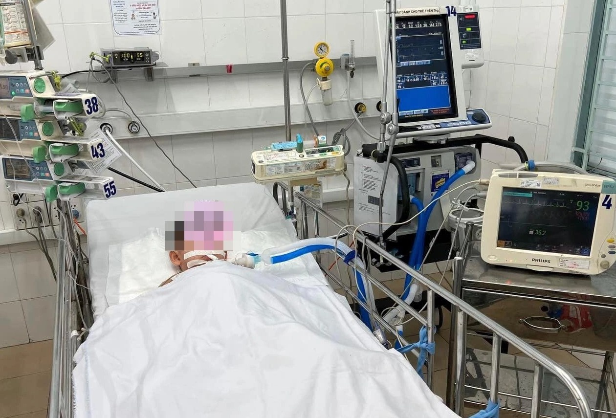 hội chứng viêm đa hệ thống sau nhiễm nCoV ảnh 1 hoi chung viem da he thong sau nhiem nCoV anh 1