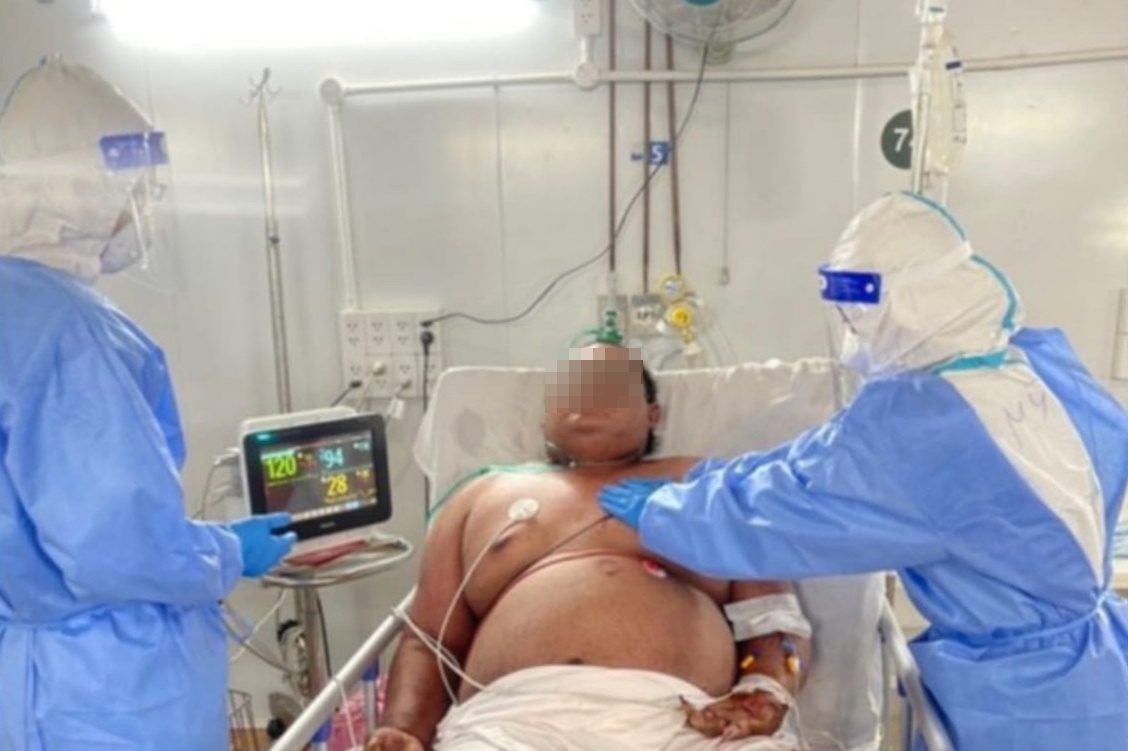 Benh nhan 28 tuoi nang 140 kg chien thang Covid-19 hinh anh