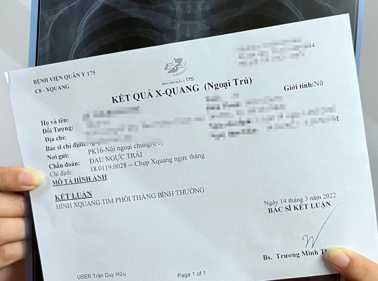 Di kham hau Covid-19 de 'bot lo lang' hinh anh
