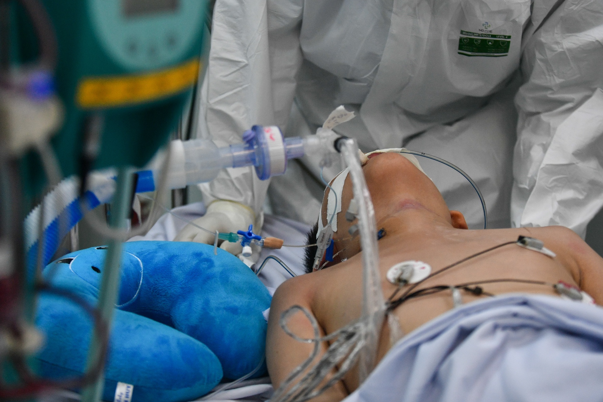 Viem mang nao do nhiem khuan nao mo cau anh 1