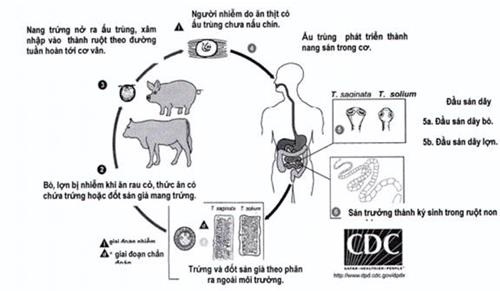 lay nhiem benh san day anh 1