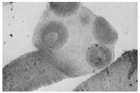 Nguy co nhiem san day tu cac goi thit trau, bo song hinh anh