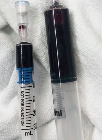 An nhieu cu den giup bo mau anh 2