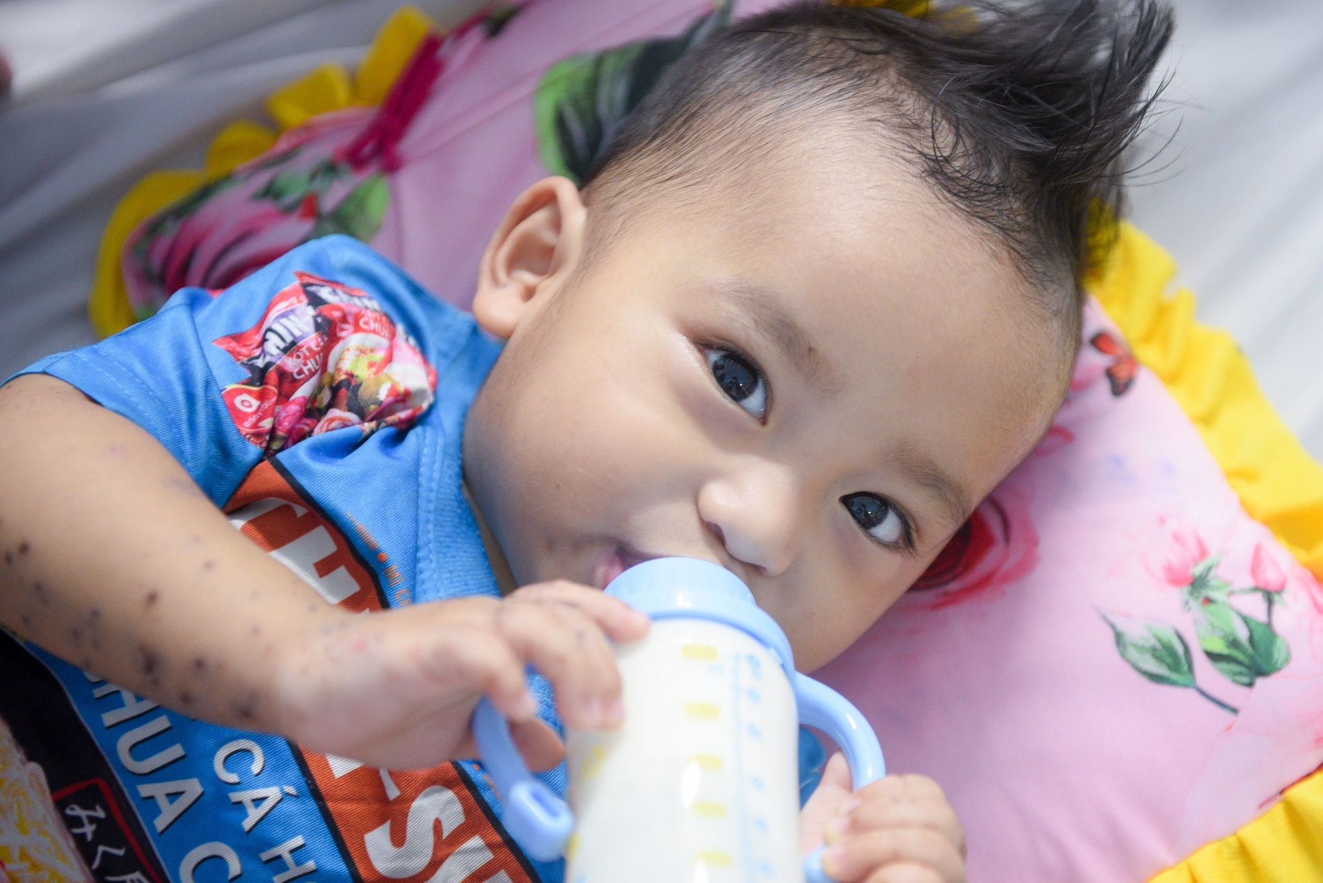 TP.HCM phat hien 123 o dich sot xuat huyet, 4 o dich tay chan mieng hinh anh