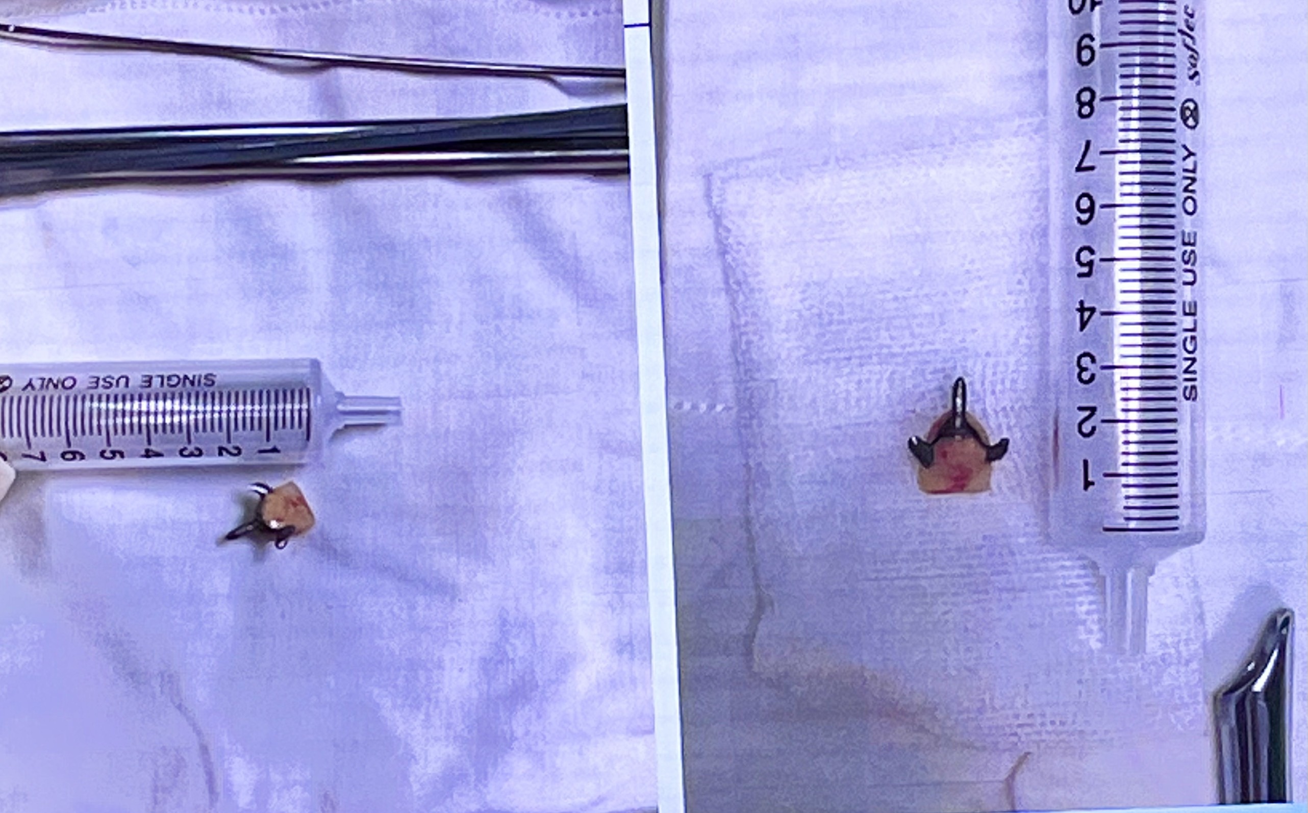 di vat duong tho rang gia anh 1