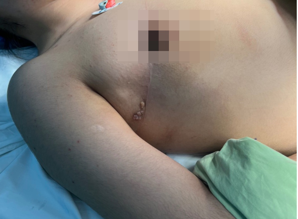 Tai tao nguc co gai anh 1