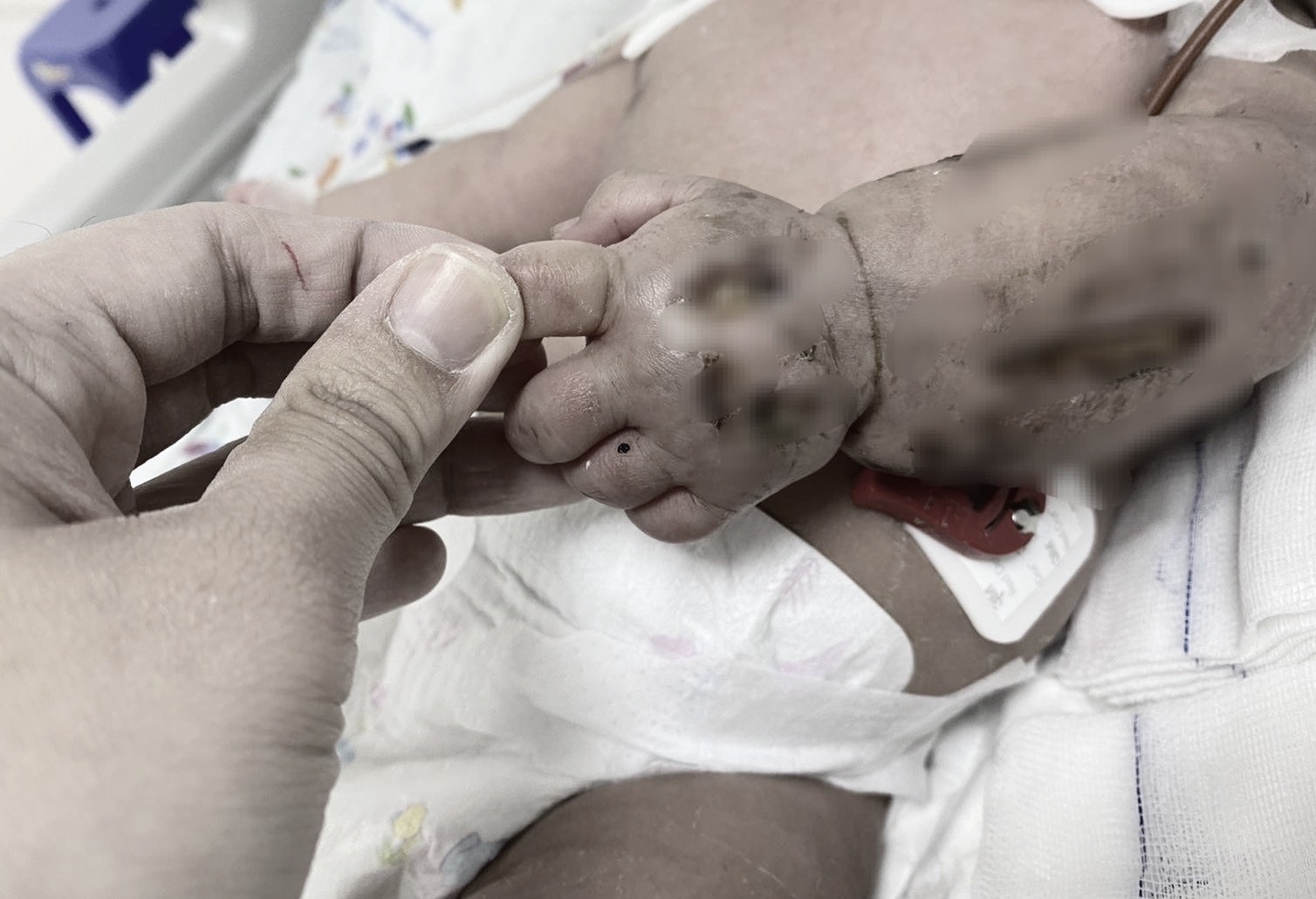 tre o TP.HCM nhap vien do tai nan sinh hoat anh 2