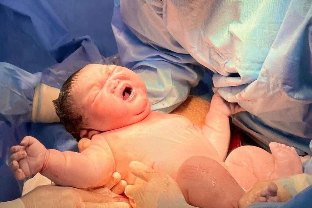 San phu o TP.HCM sinh be trai nang gan 5,8 kg hinh anh