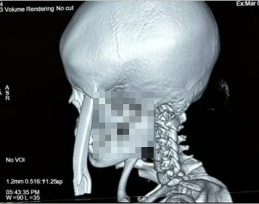 dam xuyen hoc mat anh 1