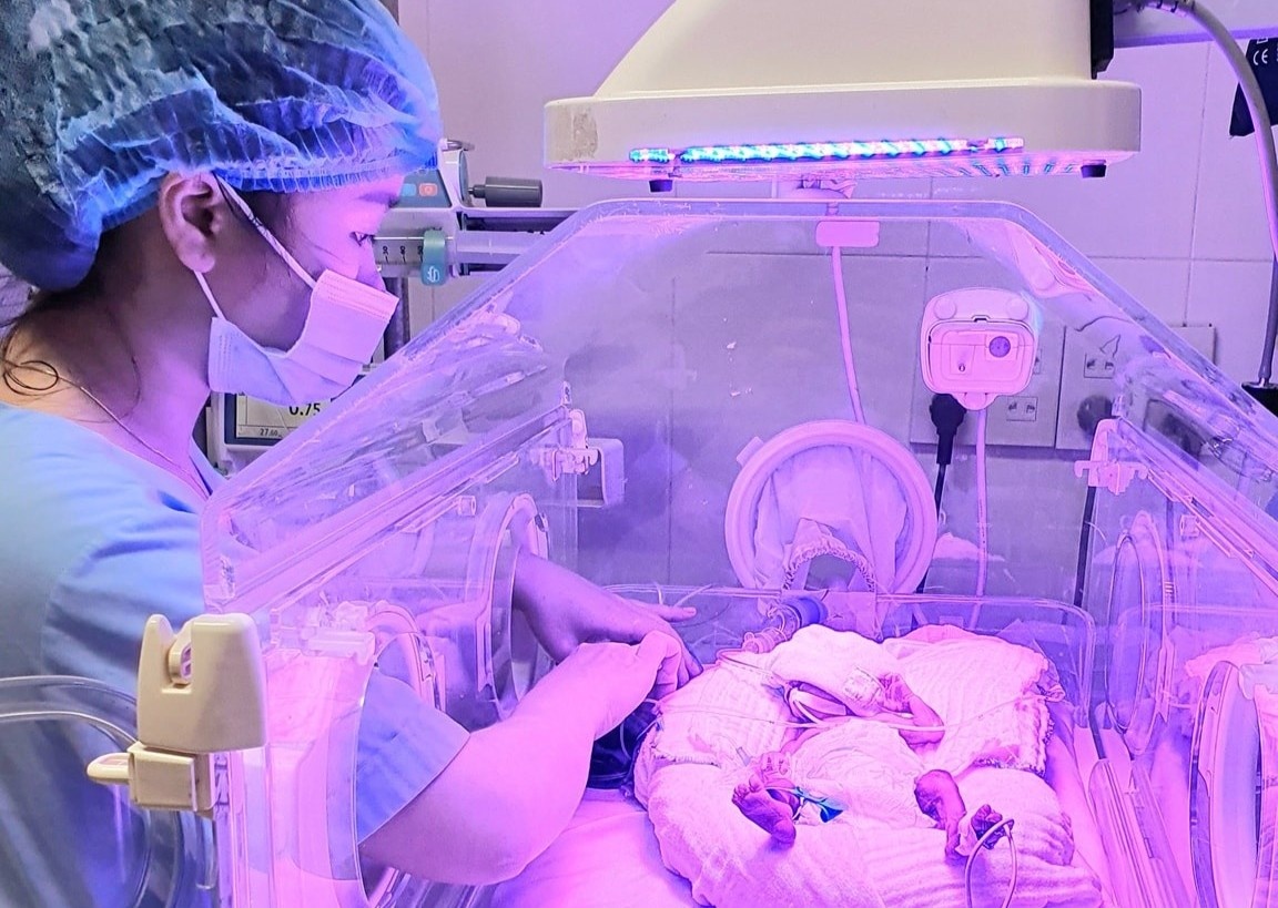 Nuoi song be so sinh nang 700 g hinh anh