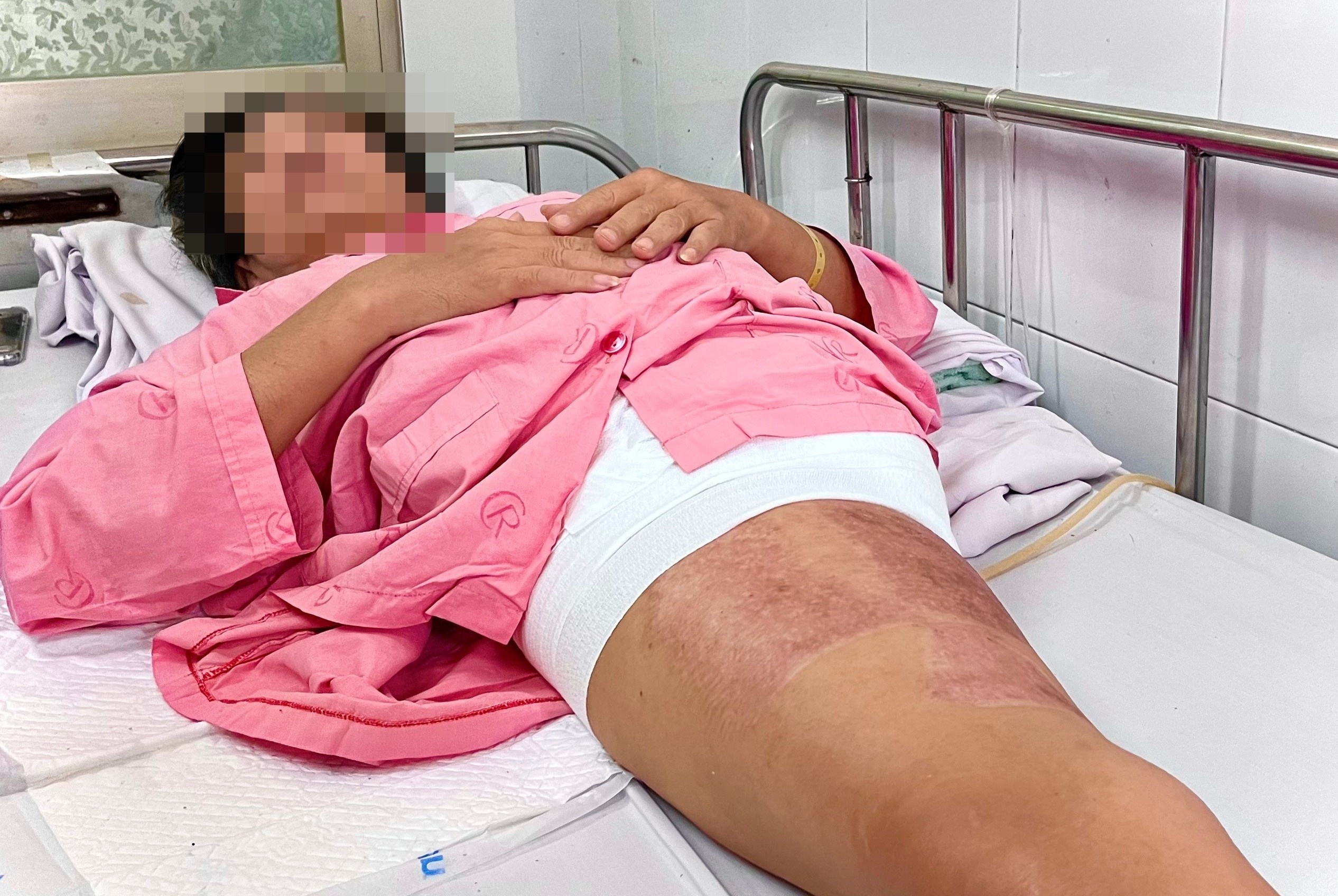 Nguoi dan ong bi can dap nat nua than duoi: 'Con song la con tat ca' hinh anh