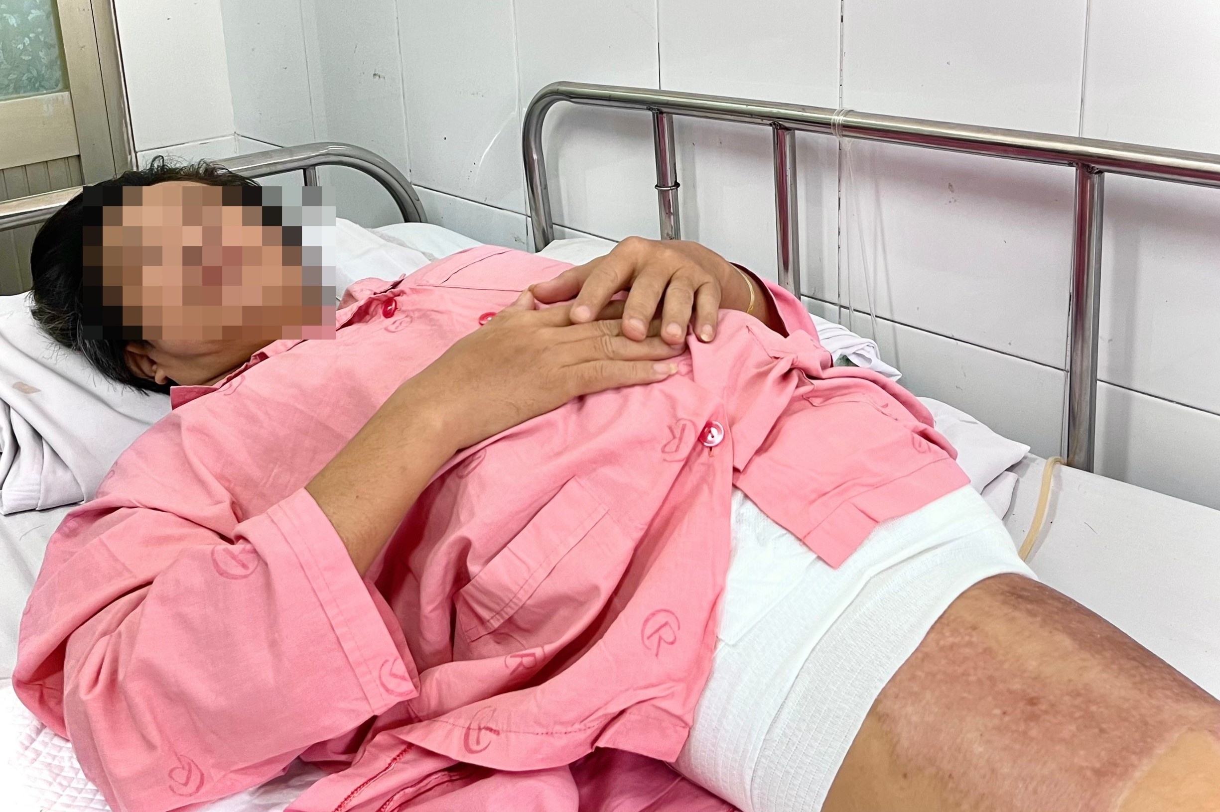 Nguoi dan ong nhap vien voi nua than duoi dap nat hinh anh