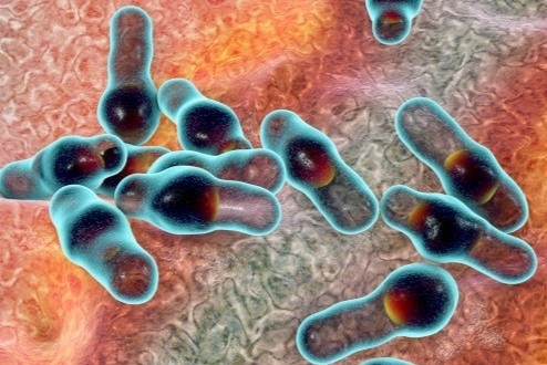 Dau hieu ban da nhiem doc Botulinum hinh anh