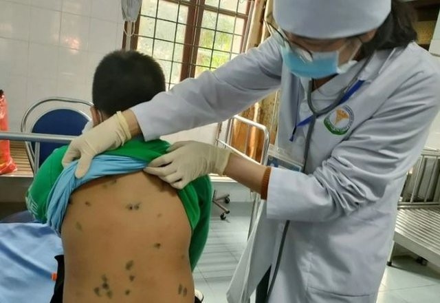 bệnh truyền nhiễm ảnh 1 benh truyen nhiem anh 1