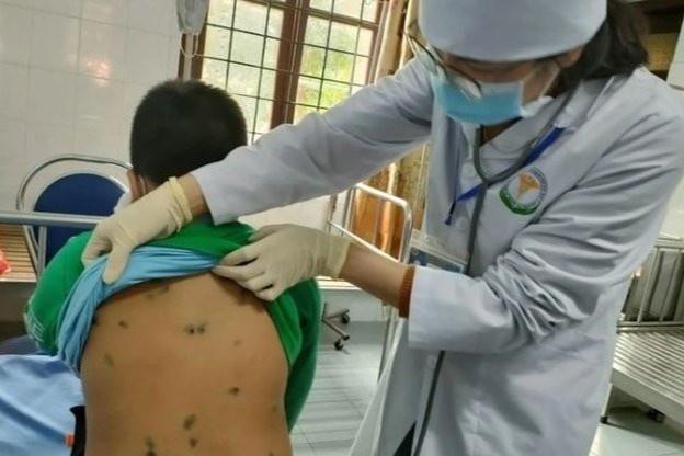 Hai benh truyen nhiem tan cong tre em Ha Noi va cac tinh phia bac hinh anh