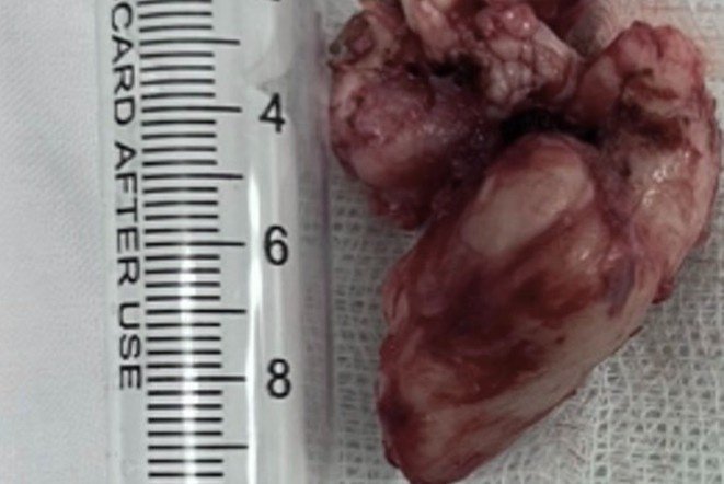 u soi mach vom hong anh 1