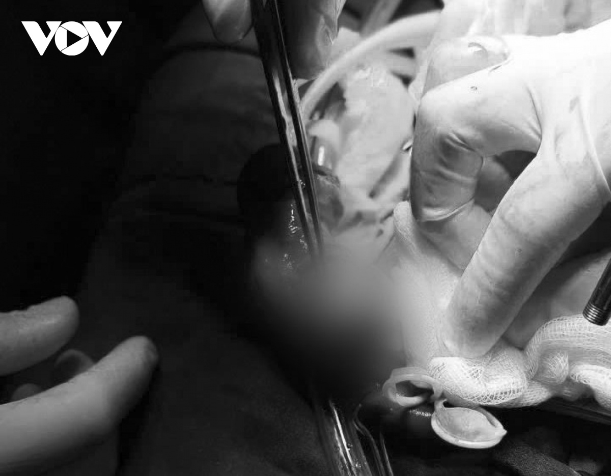 tai bien nam khoa anh 1