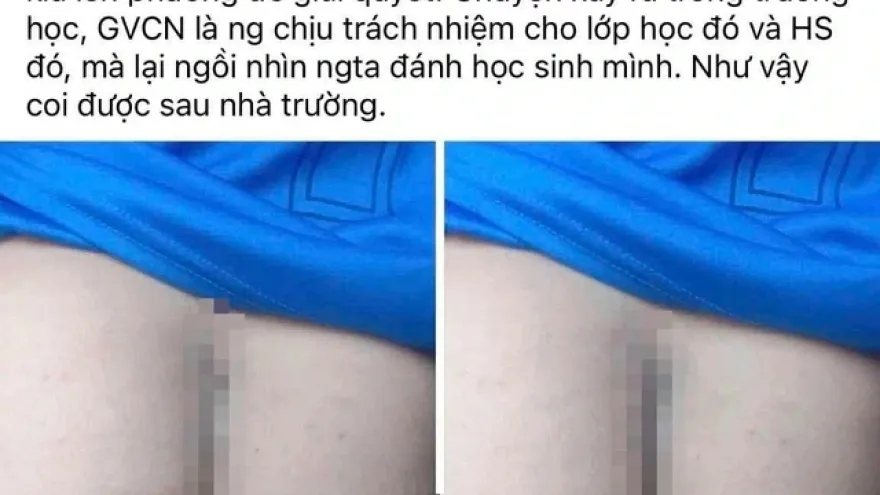Vu phu huynh vao truong danh hoc sinh: Tam dinh chi 2 giao vien hinh anh
