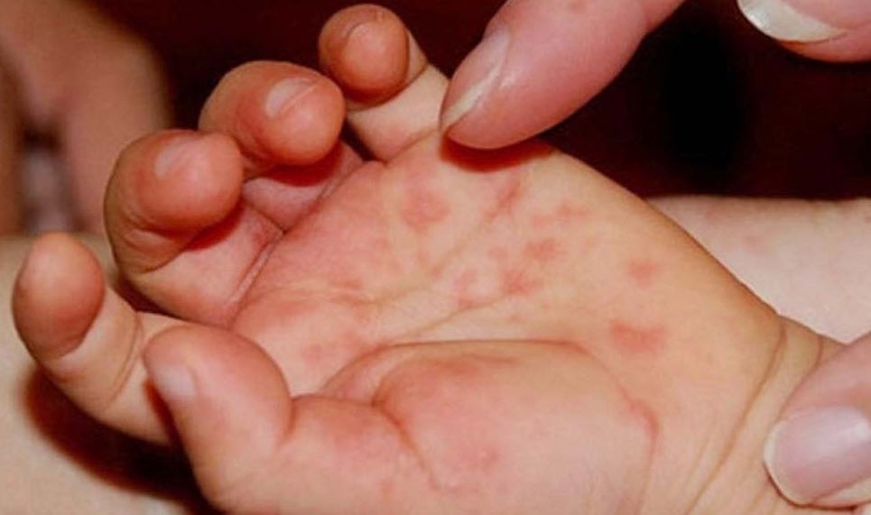 tay chan mieng anh 1