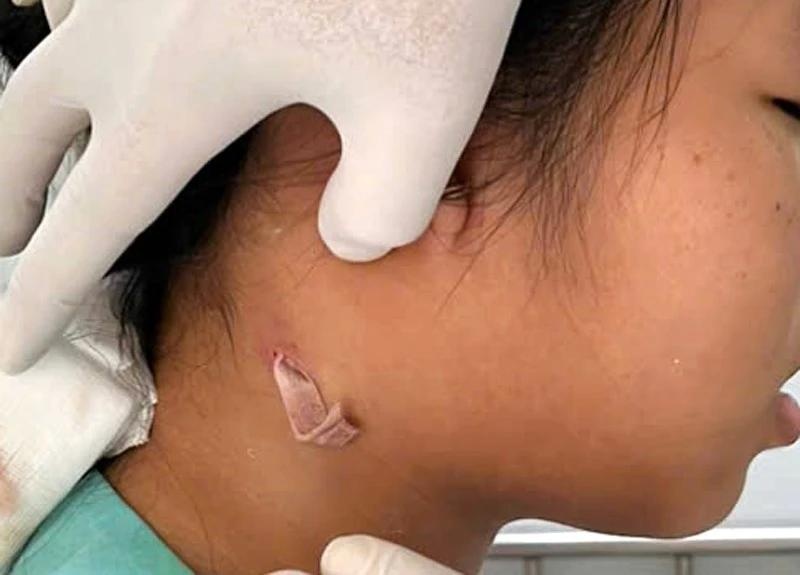 Can benh khien gioi chuc Thai Lan phai canh bao khan hinh anh