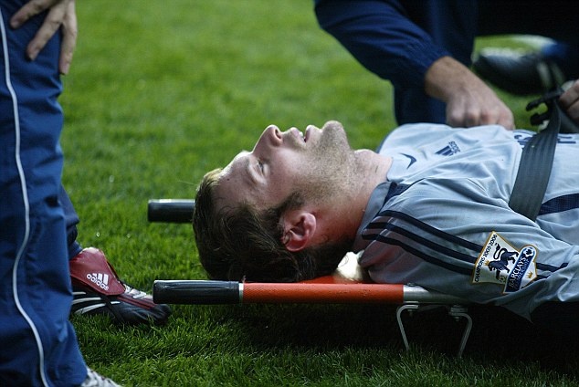 chan thuong kinh hoang cua cech anh 3