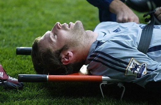 Chan thuong suyt cuop di mang song cua Petr Cech hinh anh