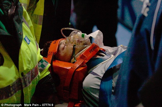 chan thuong kinh hoang cua cech anh 5