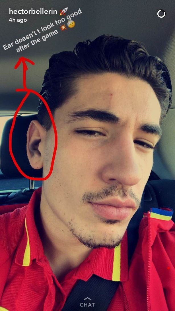 tru cot Arsenal dinh chan thuong anh 1